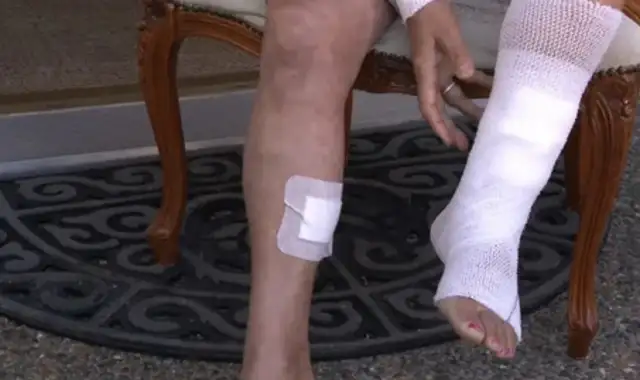 Shit! Canadian girls walk their dogs home and get bit by a bunch of raccoons