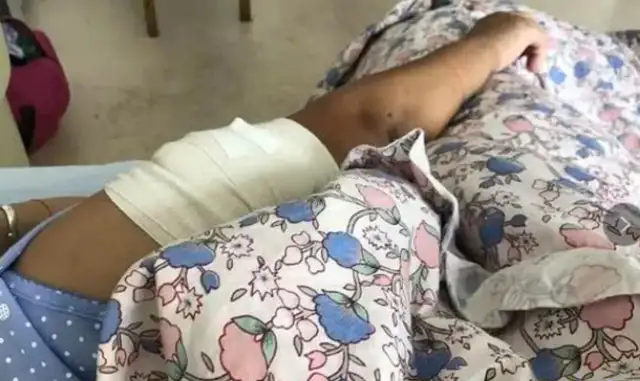 It's not the first time a woman has been bitten by a dog for five years