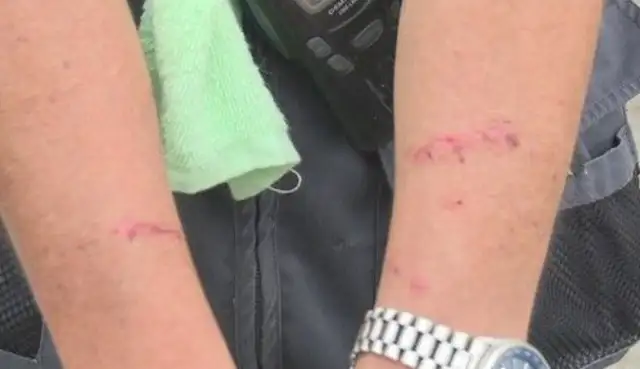 The Akitas didn't care enough to cross the river and bite three people