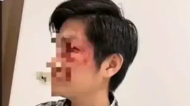 DAD KICKED A DOG WITHOUT A LEASH TO PROTECT HIS SON