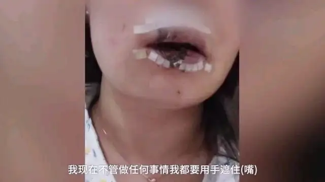 A woman fed a friend's dog, his lips were cut off in half