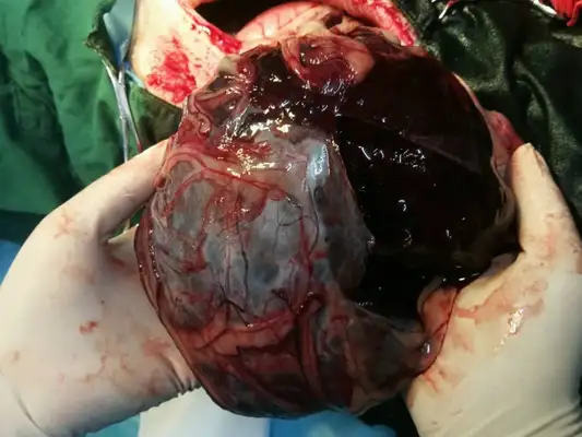 A lot of accidents with pets? Watch out for spleen break-ups and coping strategies