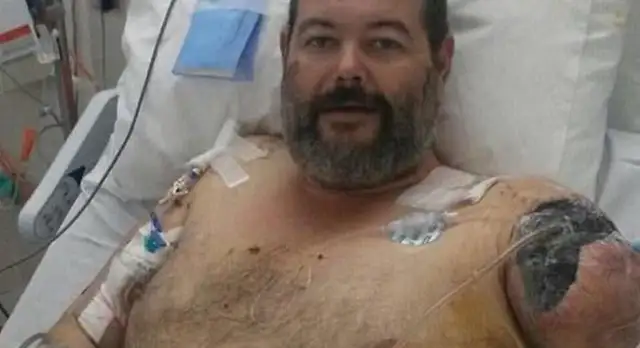 Bad dogs hurt people! Australian men were hit by two hounds for their clients, their arms torn alive. Drop it