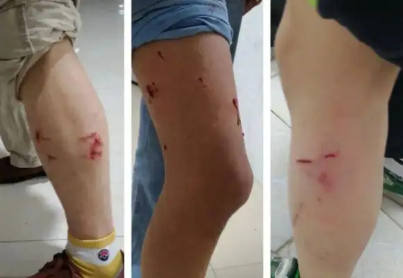 3 dogs in Hunan, wounded 16 people