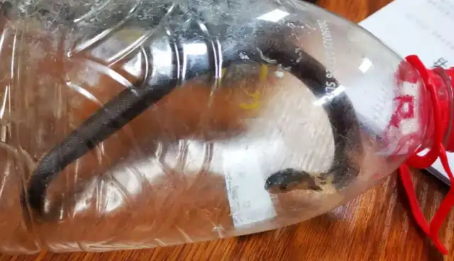 He was bitten by a cobra and brought the killer to the hospital