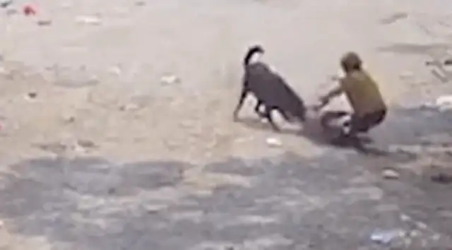 The 72-year-old lady had been bitten by two of her dogs