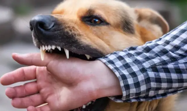 It's a big deal! Chengdu Zhuong dog bites after: Black dog has found out, the dog owner apologizes