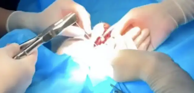 The dog's jaw is broken and he can't eat