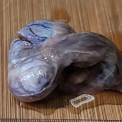 Diagnosis and treatment of a dog testicular tumor