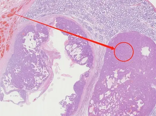 Diagnosis and treatment of a dog testicular tumor