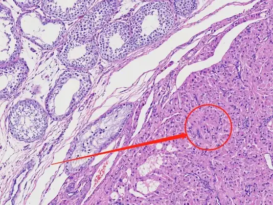 Diagnosis and treatment of a dog testicular tumor