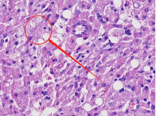 Diagnosis and treatment of a dog testicular tumor