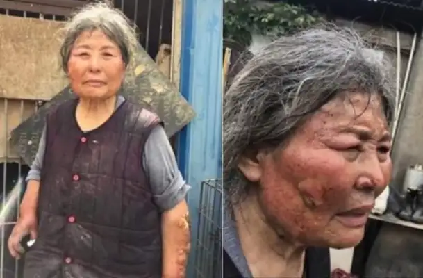 The dog was bit in the water by a crocodile. The master broke open his mouth and saved the dog