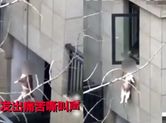The 12-year-old boy was bitten by four dogs. This time, Dog Lover came out