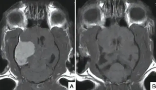 Understanding cat epilepsy: classification, diagnosis and treatment strategies