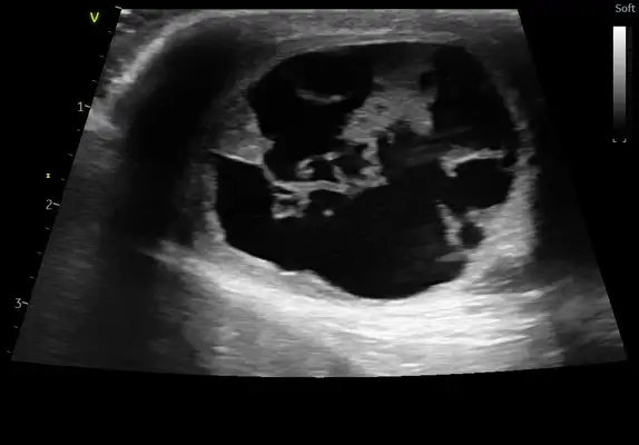 Diagnosis and treatment of a dog testicular tumor