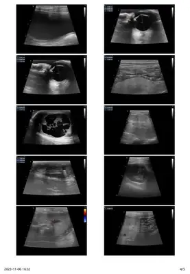 Diagnosis and treatment of a dog testicular tumor