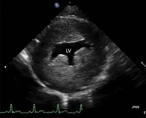 Early identification and treatment of cat fat heart disease: case sharing and diagnostic techniques