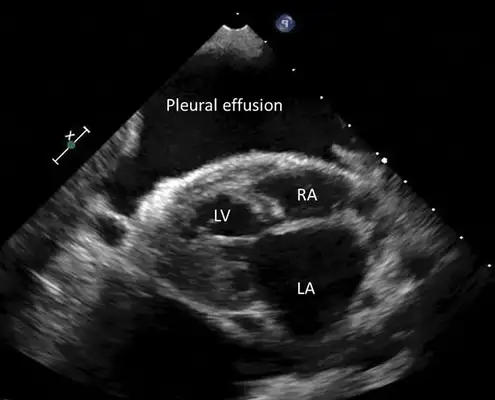 Early identification and treatment of cat fat heart disease: case sharing and diagnostic techniques