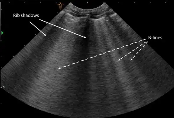 Early identification and treatment of cat fat heart disease: case sharing and diagnostic techniques