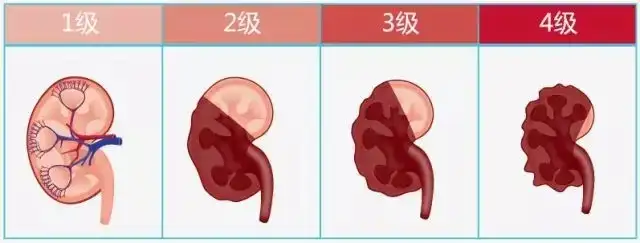 Cat kidney disease, early symptoms and prevention